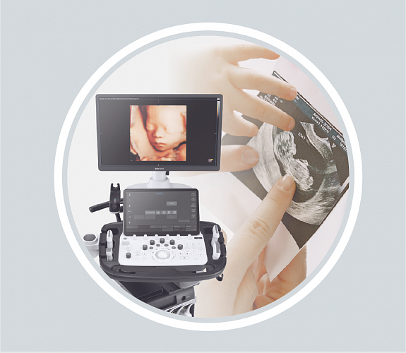 Prenatal diagnostikada ultratovush tekshiruvining ahamiyati