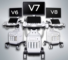 Искусственный интеллект для точной диагностики – теперь в Samsung V6, V7 и V8!