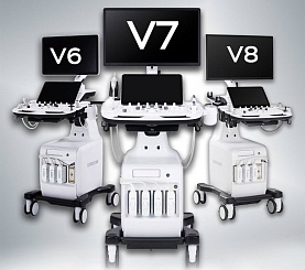 Aniq diagnostika uchun sun'iy intellekt – endi Samsung V6, V7 va V8 da!